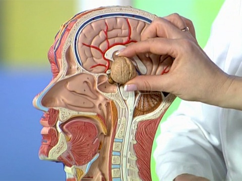 Информативное видео: Астроцитома головного мозга, в чем опасность онкоопухоли?