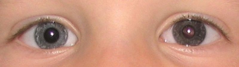 Немного из анатомии: из чего состоит глаз человека?