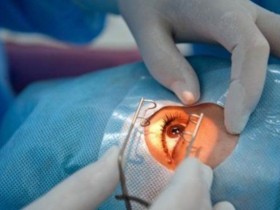 Причины ретинобластомы глаза