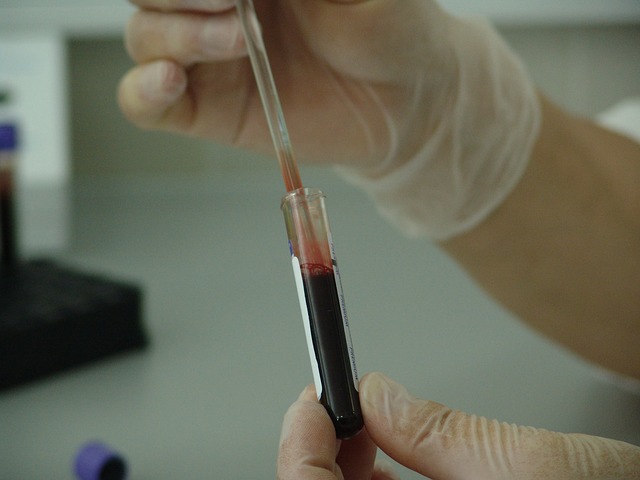 Анализ крови на онкомаркер лейкоз thumbnail