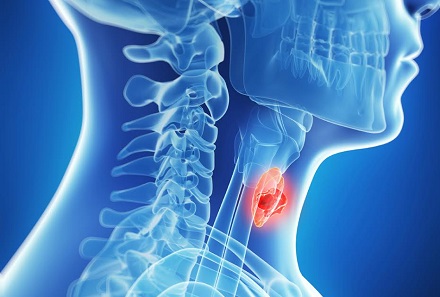 Особенности развития папиллярного рака щитовидной железы